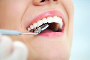 つくばの歯医者　歯磨き指導　ブラッシング法を伝授
