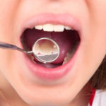 つくばの歯医者　子供の歯並び矯正治療