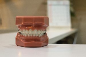 歯列矯正中の痛み_つくばのつるみ矯正歯科